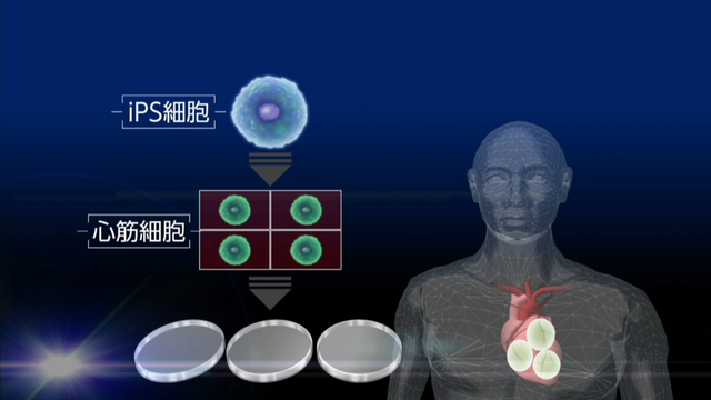 В Японии провели операцию на сердце с использованием особого типа стволовых клеток