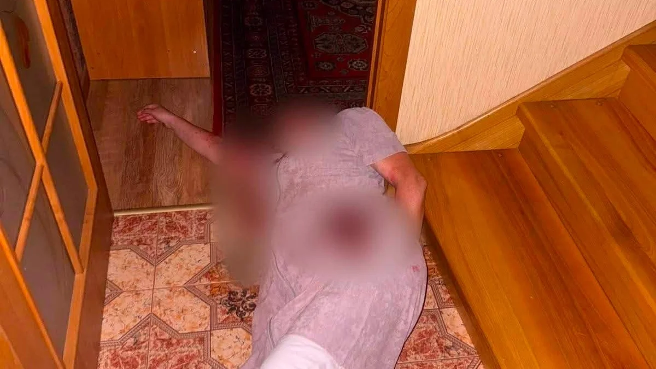 Відомий київський хірург Микола Поліщук найняв «кілера» для ексдружини, з якою прожив 33 роки: причина, що відомо