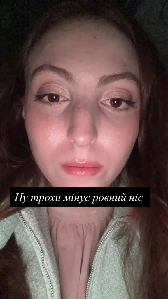 Маша Полякова показала обличчя на третій день після ДТП