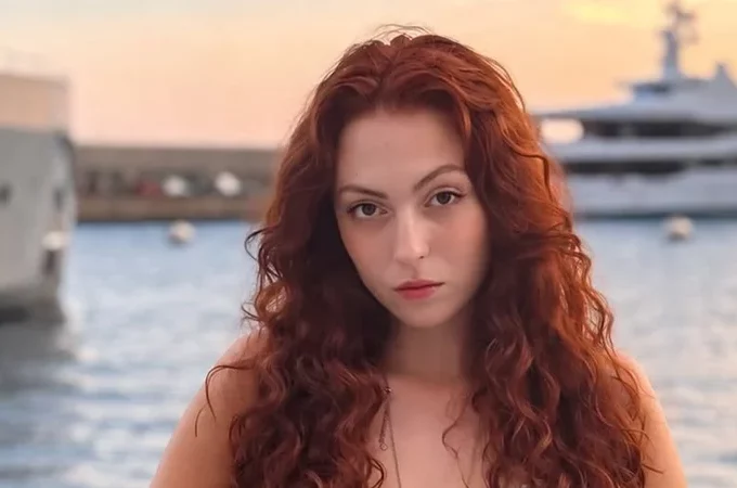 Маша Полякова показала обличчя на третій день після ДТП